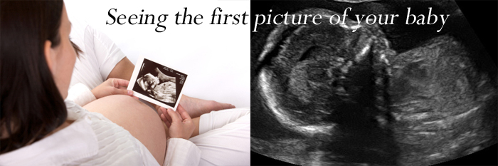 jlt-seeing-the-first-picture-of-your-baby
